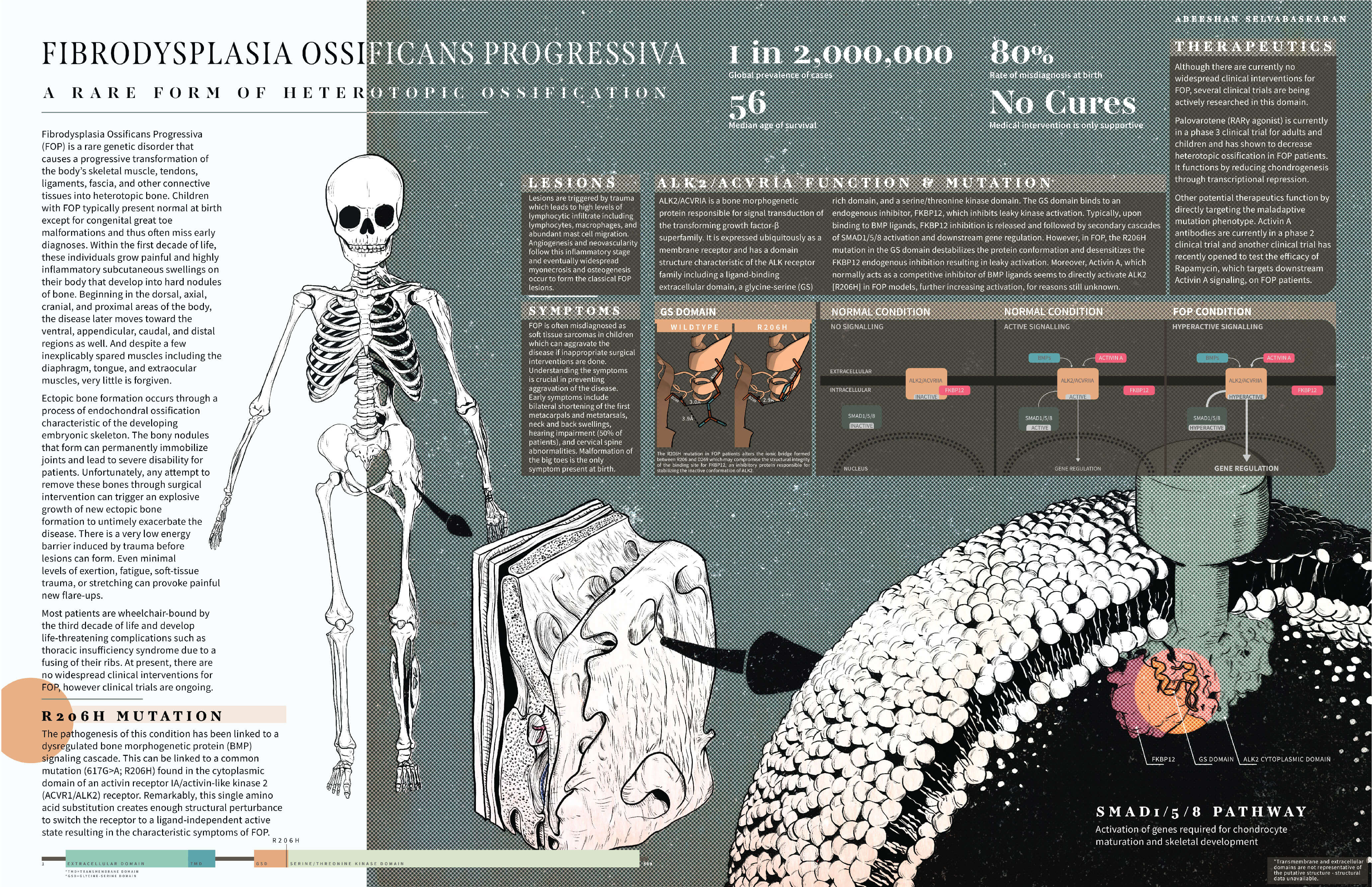 new research on fibrodysplasia ossificans progressiva