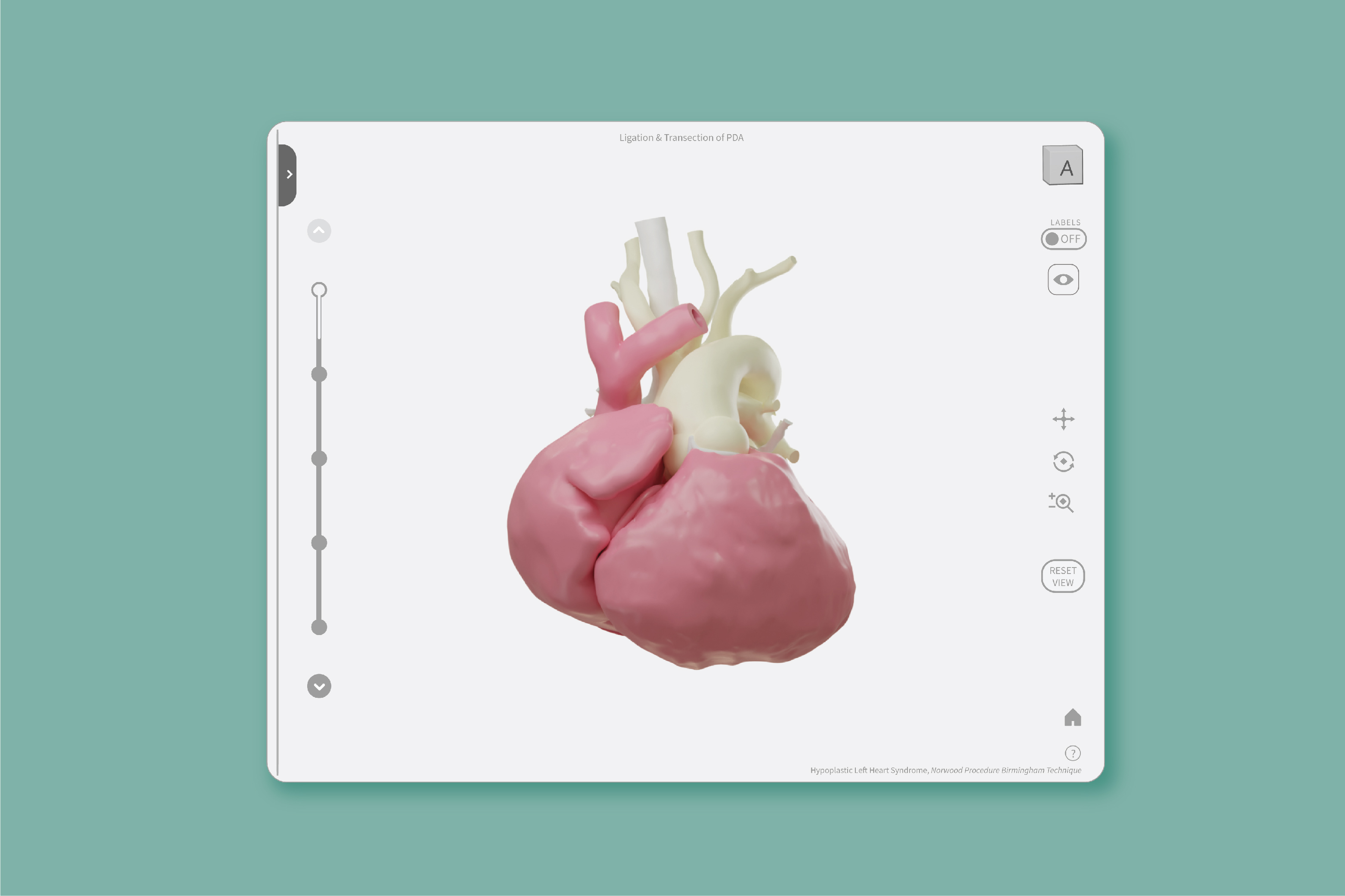 Banner image for 3D Print heart MRP