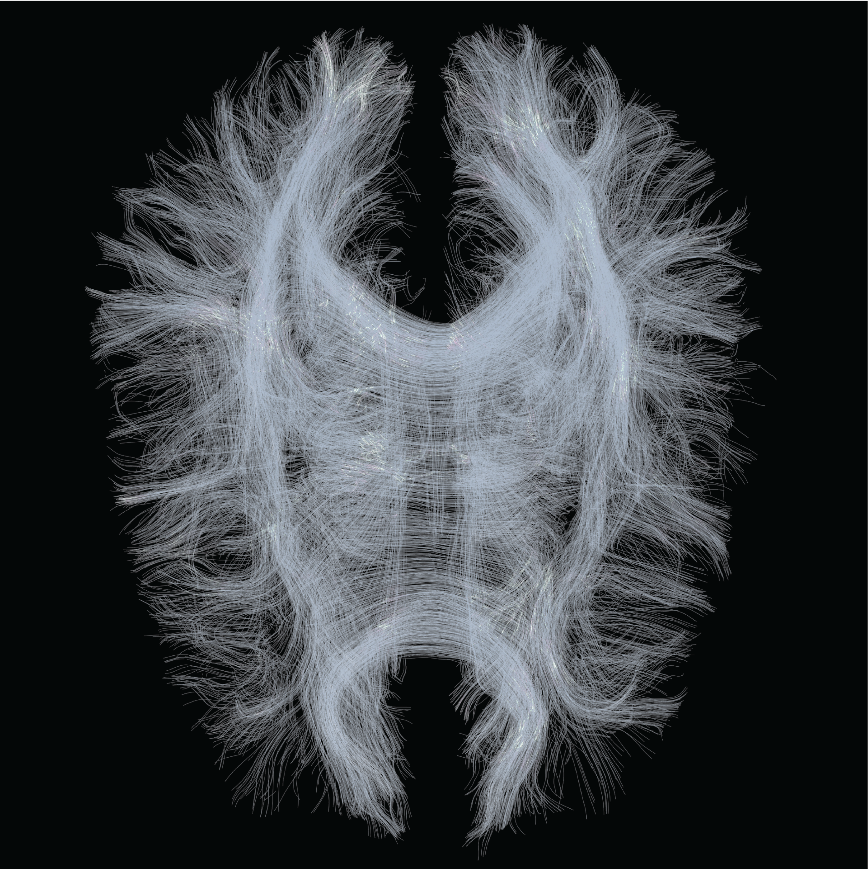 Tractography Final Render 3